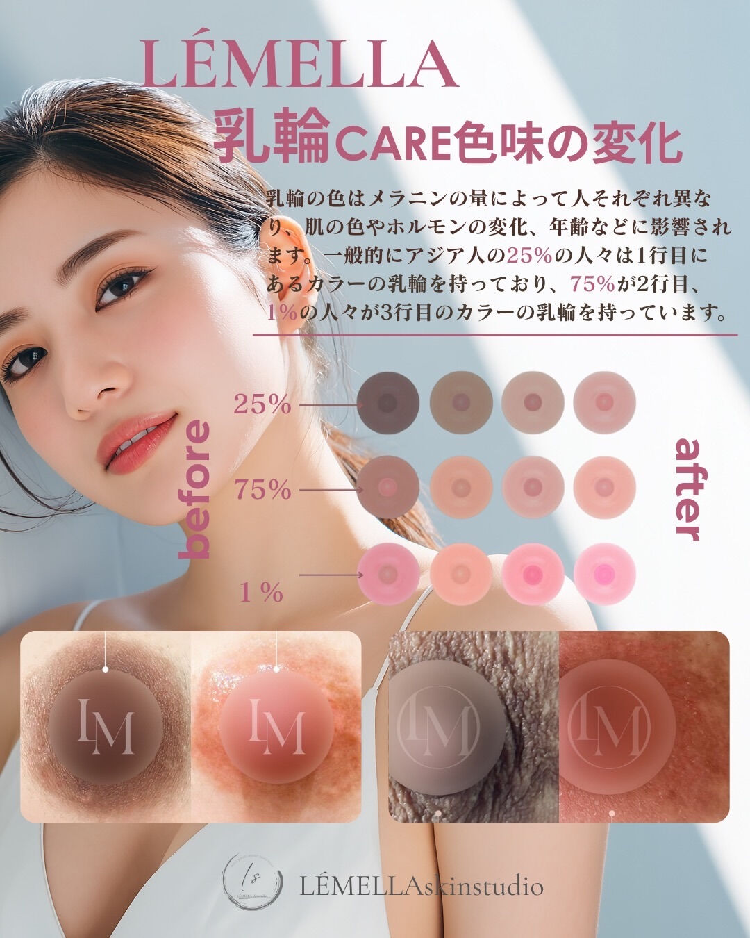 乳輪の色味は、人によって本当に様々です