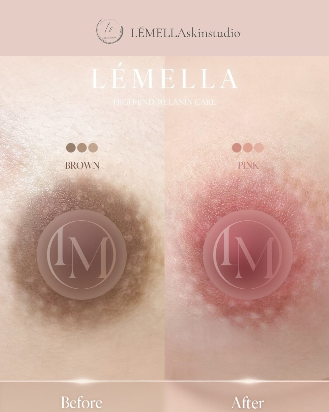 乳輪の色味は、人によって本当に様々です
