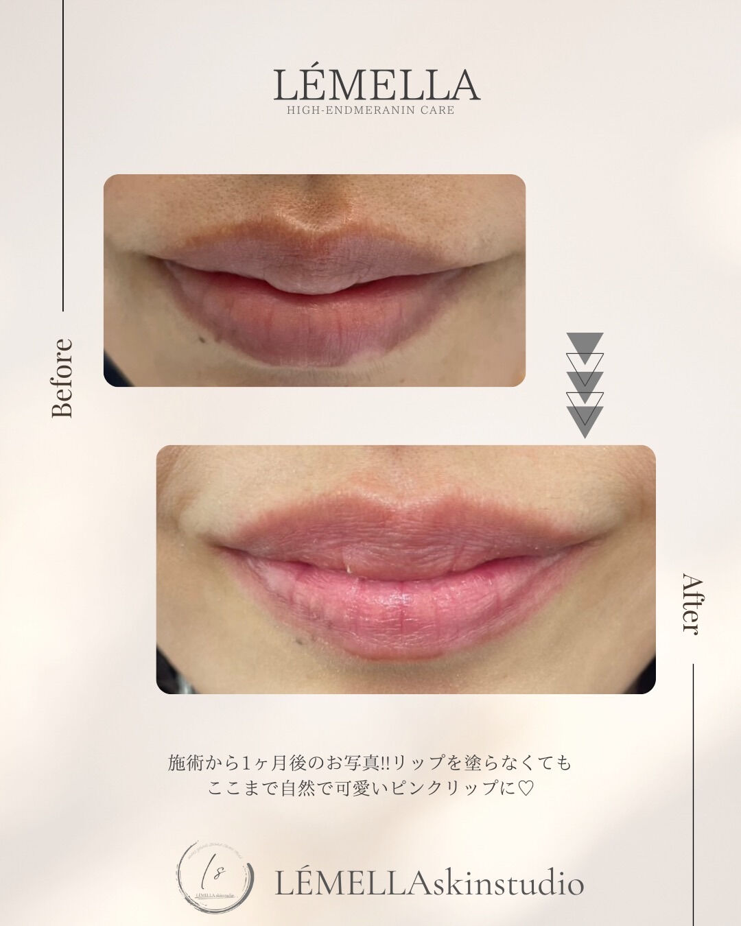 すっぴんでも可愛い“ピンクリップ”に🫧 