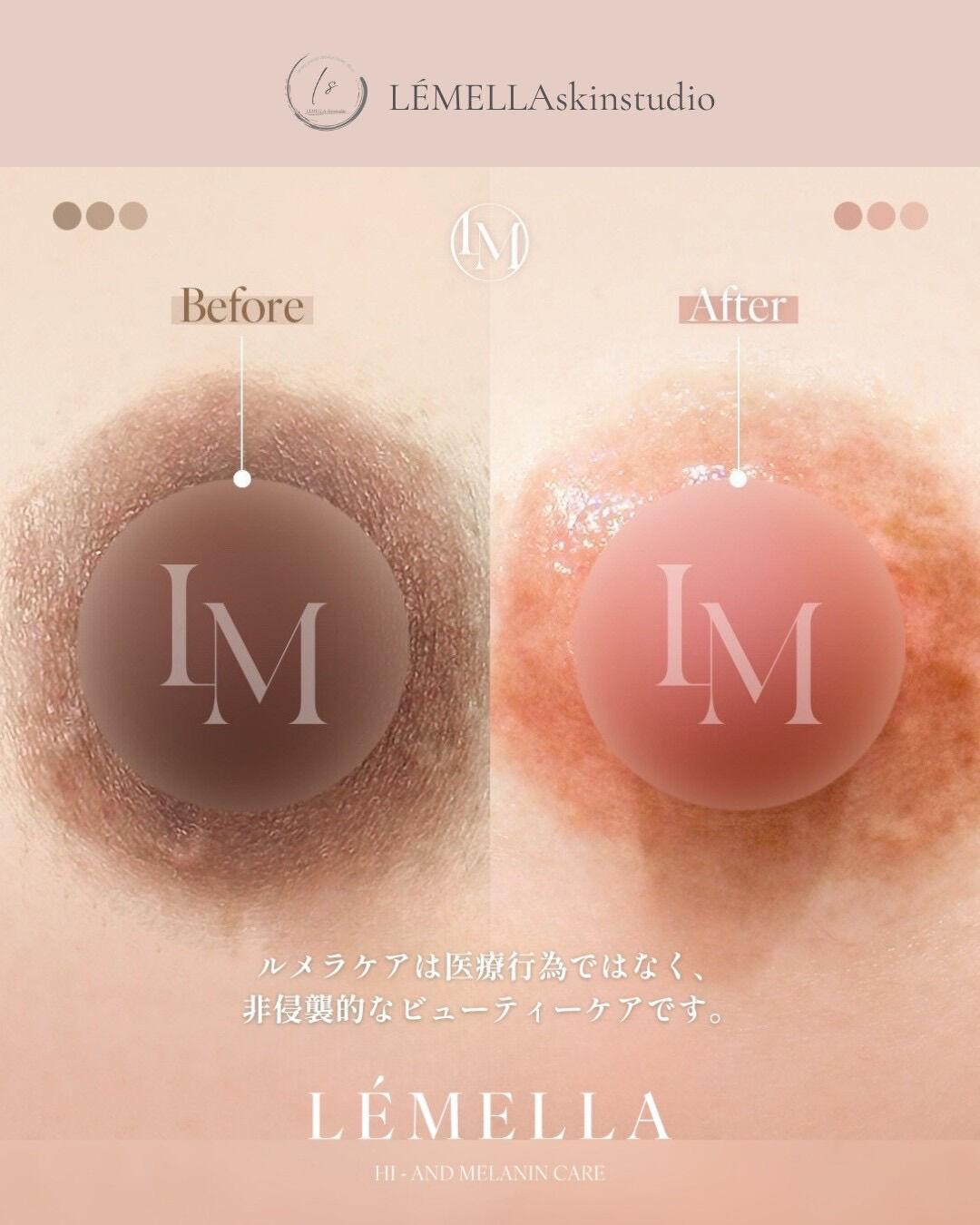 私って女性として魅力がないの…？