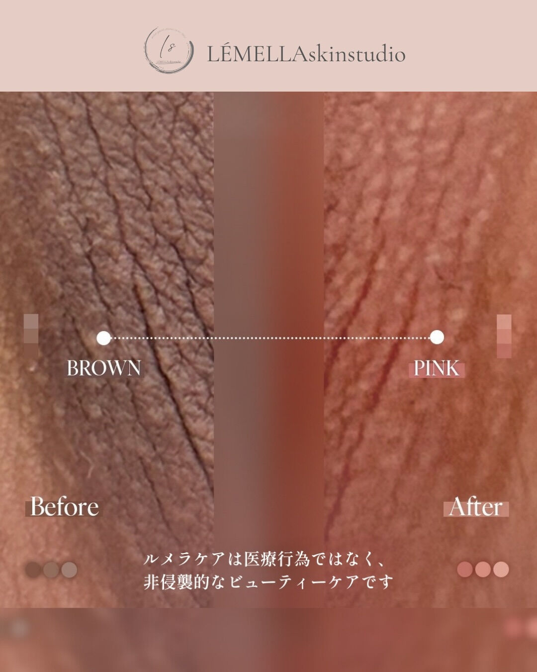 私って女性として魅力がないの…？