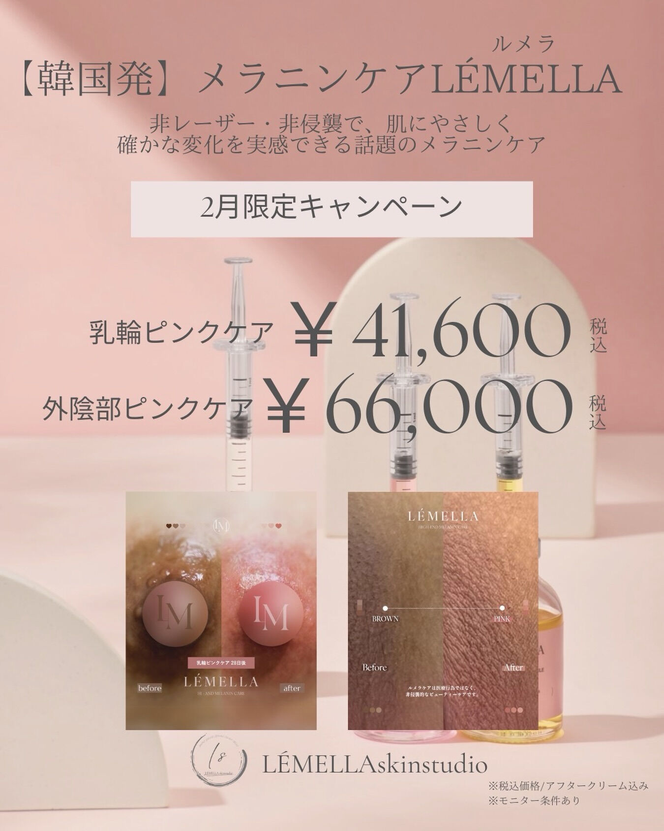 2月限定キャンペーン価格のご案内