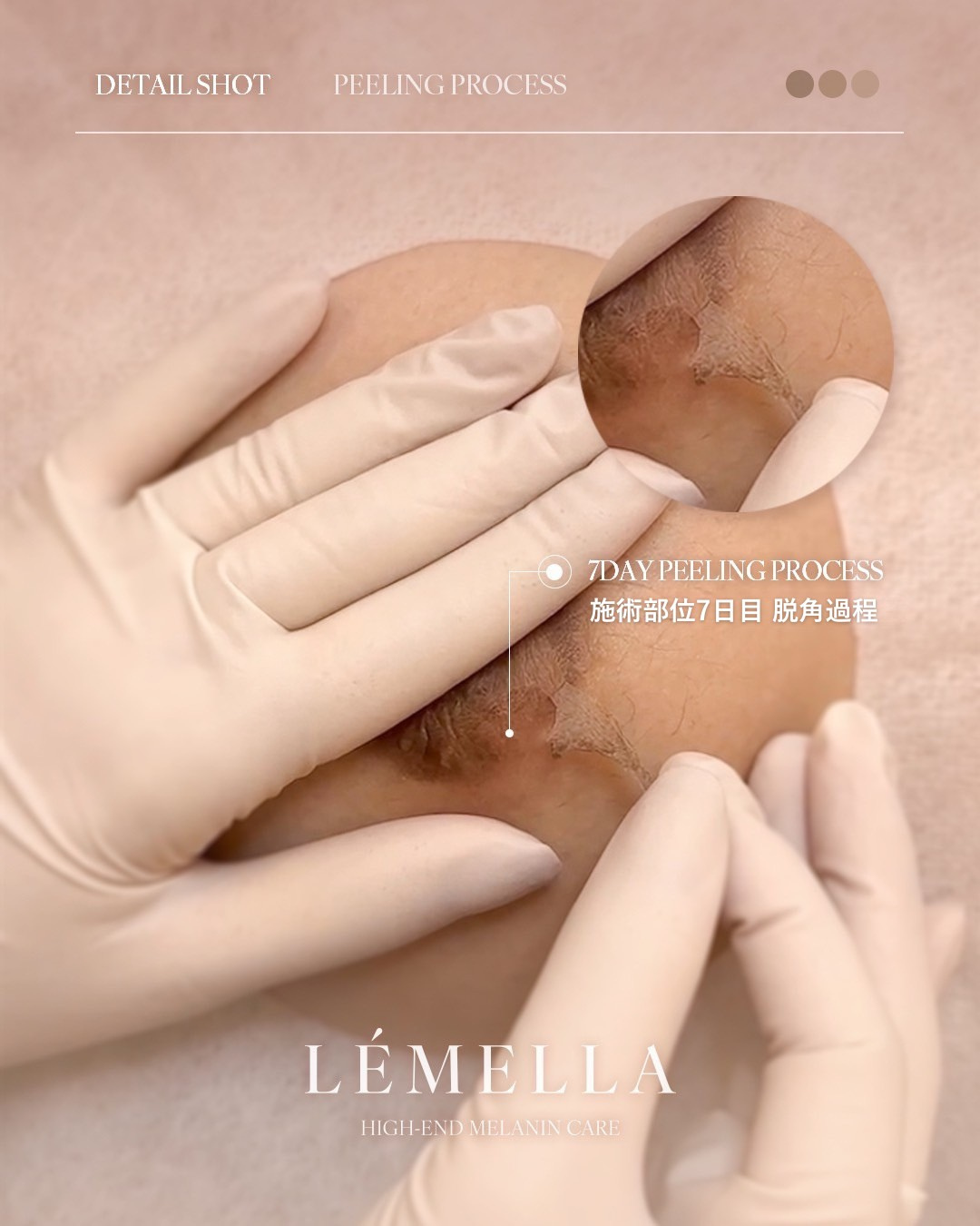 LEMELLAの【フェムケア】