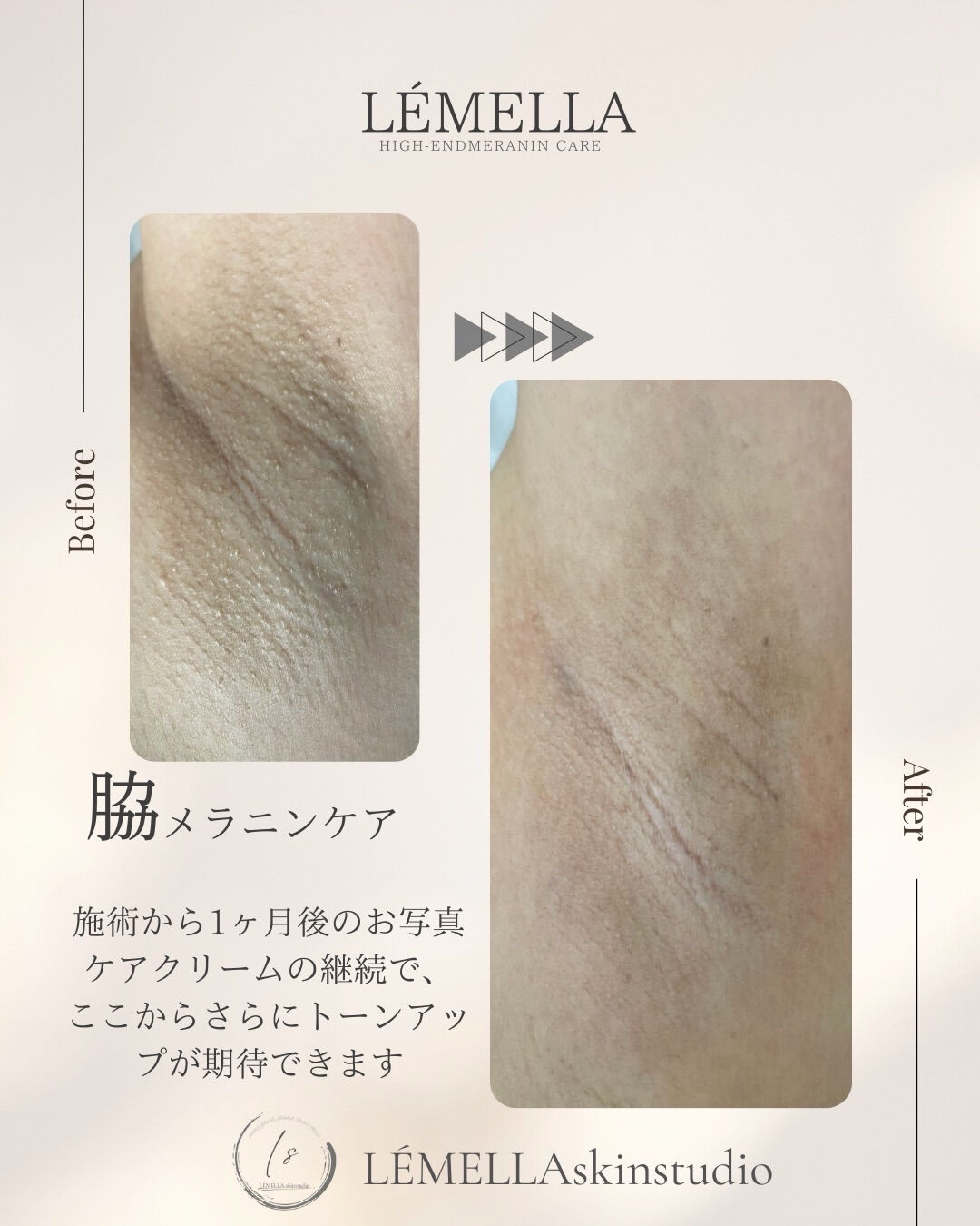 ＼3月限定🌷各部位先着3名様／