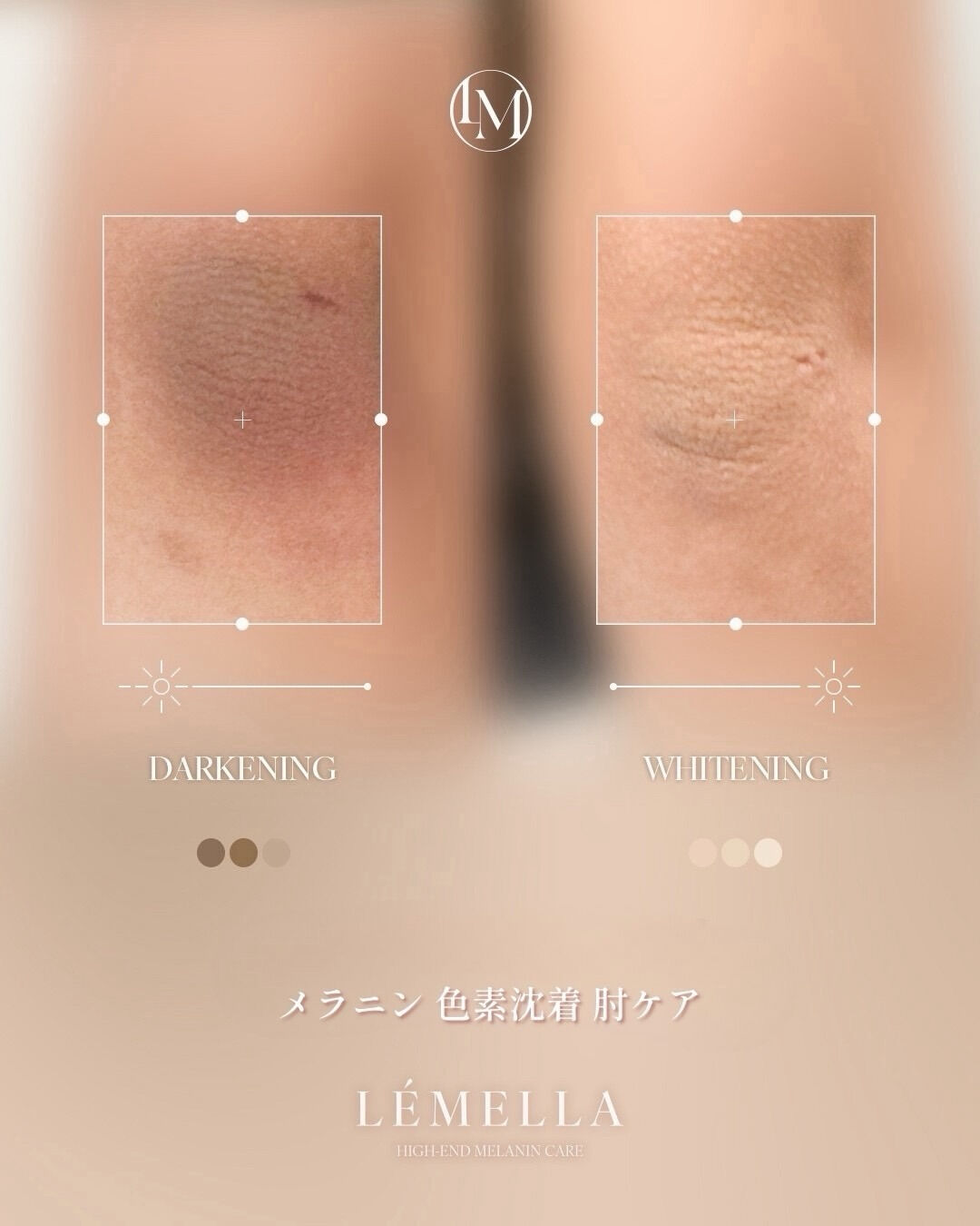 ＼3月限定🌷各部位先着3名様／