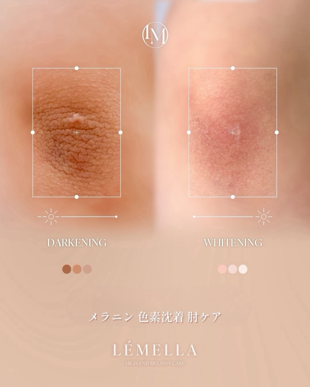 ＼3月限定🌷各部位先着3名様／