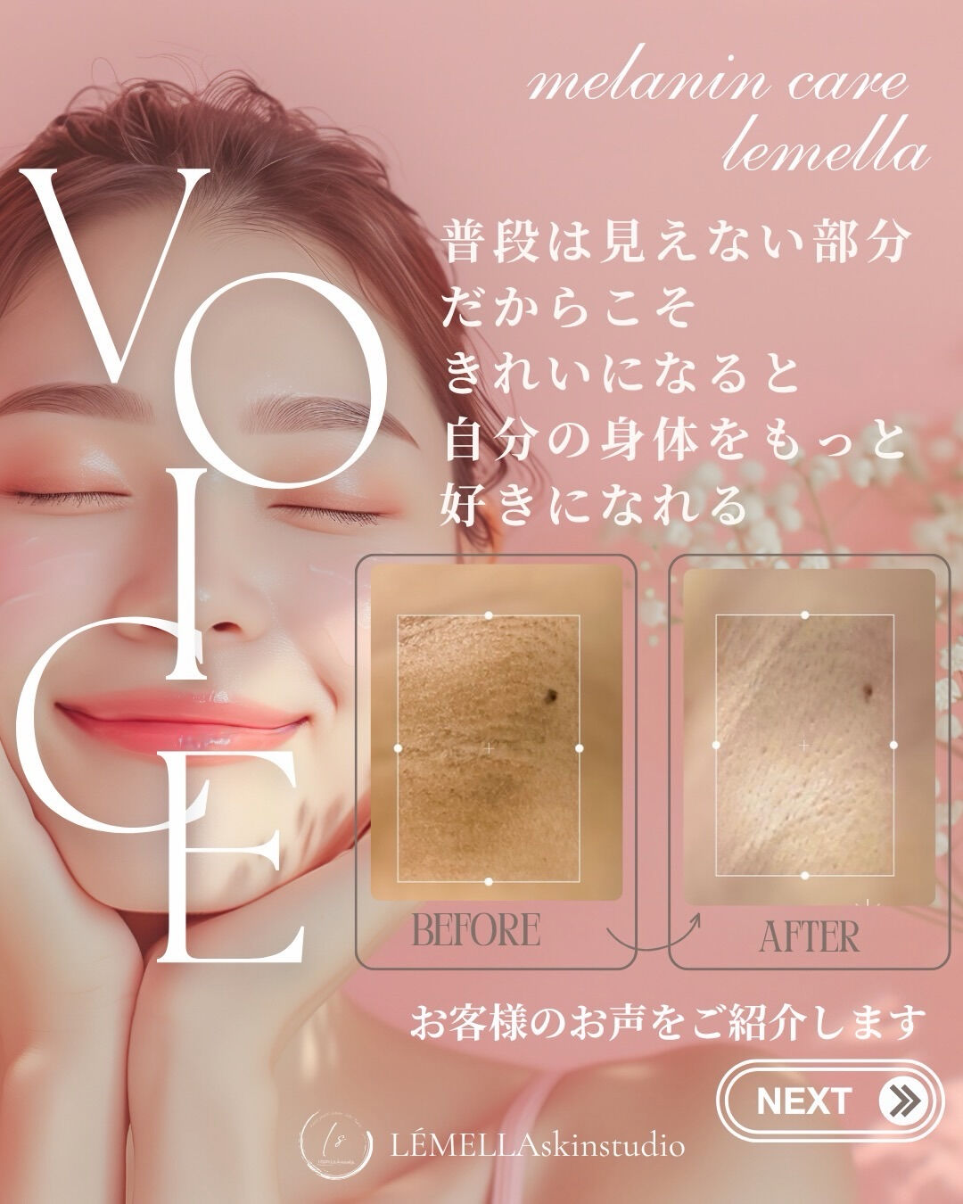 ＼お客さまのリアルなお声をご紹介／