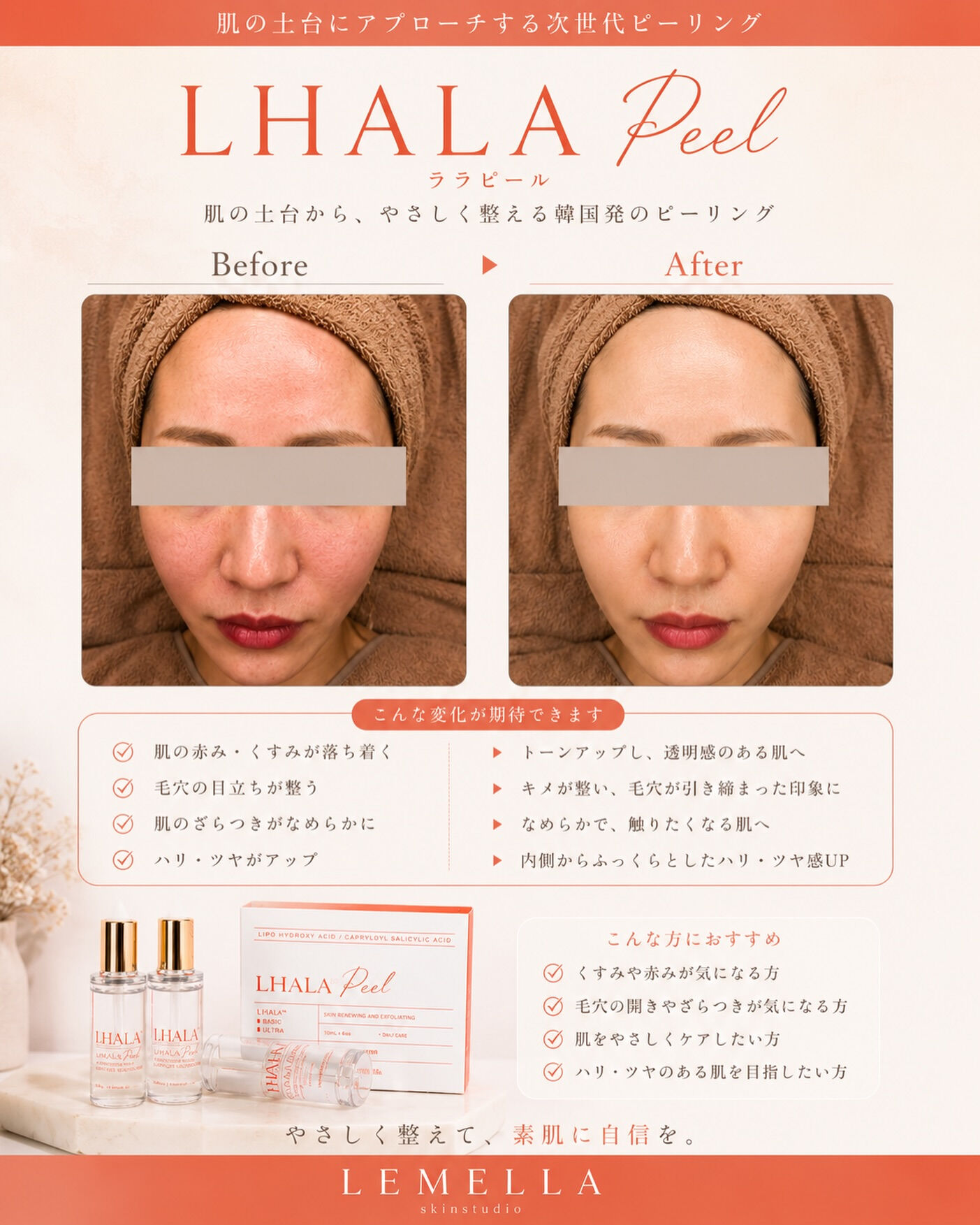 LHALA Peel 