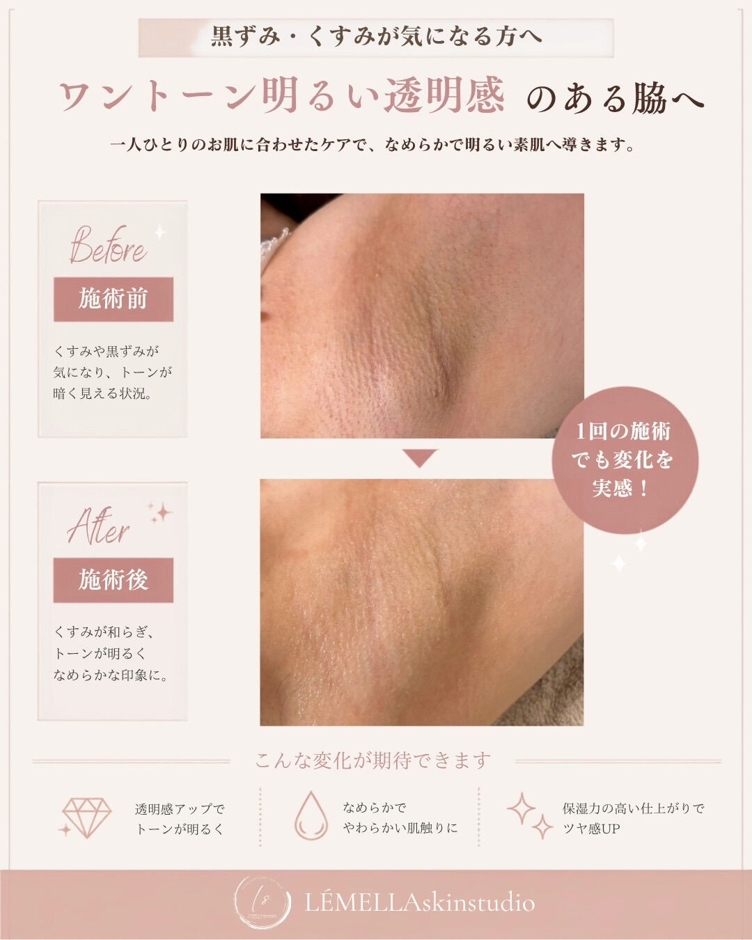 【1回でも変化を感じた♪】